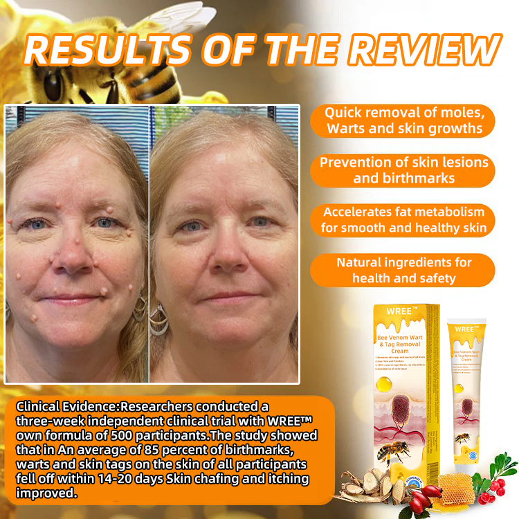 🐹WREE™ Bee Venom Wart & Tag Removal Cream(👨⚕Suitable for all skin types)🐝(🔥Last day promotion 60% off)