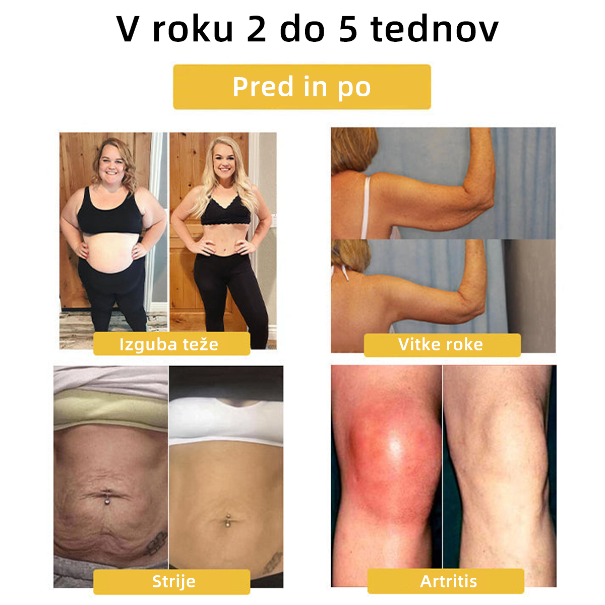 Zadnjih nekaj dni prodaje, izključno 20% off-❤️🔥 𝐶𝑍𝑇𝐼𝐼𝐶𝐿𝐸™ Terapevtski magnetni limfni obroč z mačjim očesom💍