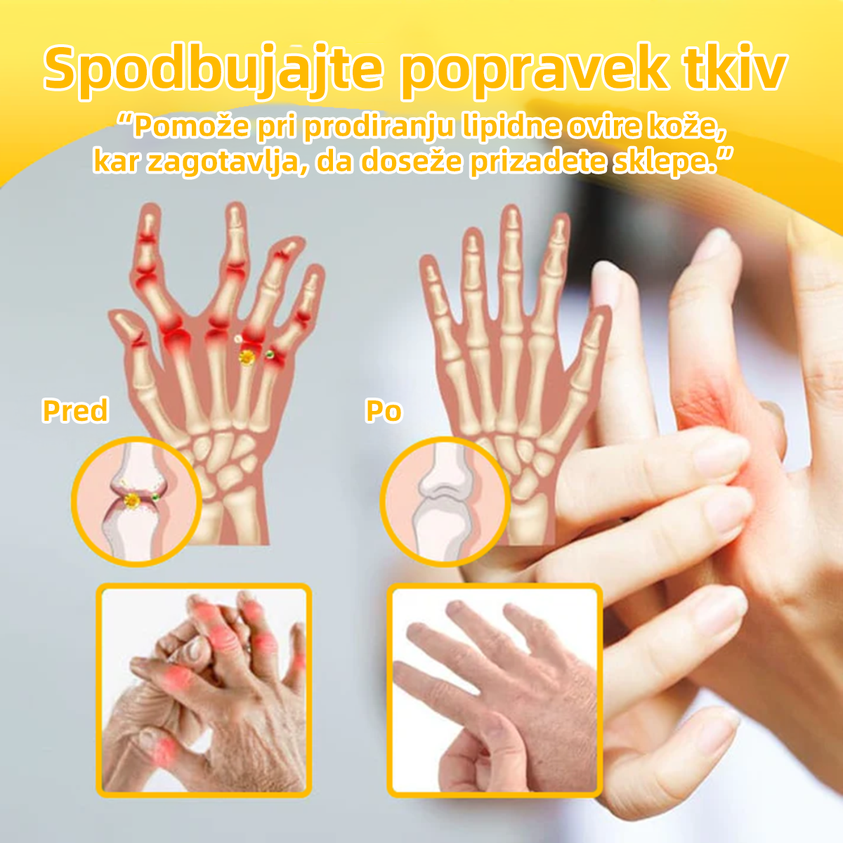 ๐ญ๐จ๐ป๐ถ๐ต๐ฎยฎ Bijeenjingi krem za obnovo kosti s pijinverliฤitvijo (Posebno za starejลกe z omejenimi moลพnostmi gibanja in predpisan od NVOC)๐ฏ