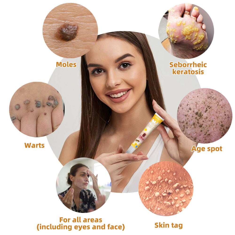 🐹WREE™ Bee Venom Wart & Tag Removal Cream(👨⚕Suitable for all skin types)🐝(🔥Last day promotion 60% off)