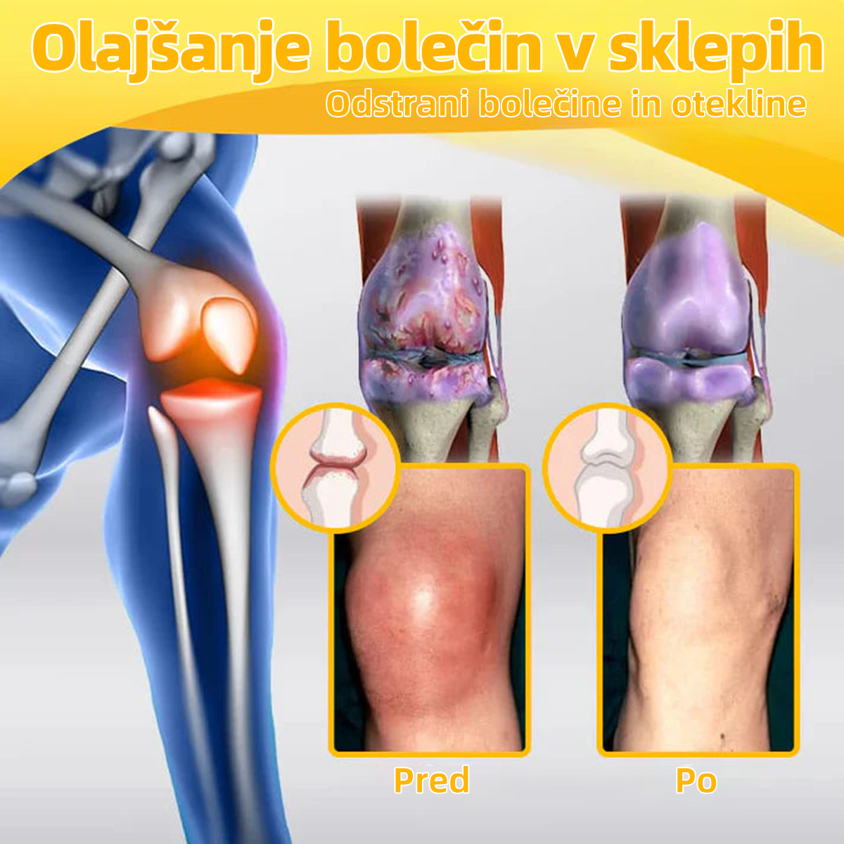 ๐ญ๐จ๐ป๐ถ๐ต๐ฎยฎ Bijeenjingi krem za obnovo kosti s pijinverliฤitvijo (Posebno za starejลกe z omejenimi moลพnostmi gibanja in predpisan od NVOC)๐ฏ