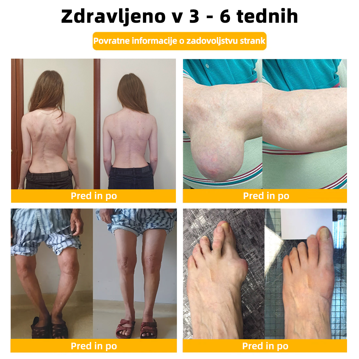 ๐ญ๐จ๐ป๐ถ๐ต๐ฎยฎ Bijeenjingi krem za obnovo kosti s pijinverliฤitvijo (Posebno za starejลกe z omejenimi moลพnostmi gibanja in predpisan od NVOC)๐ฏ