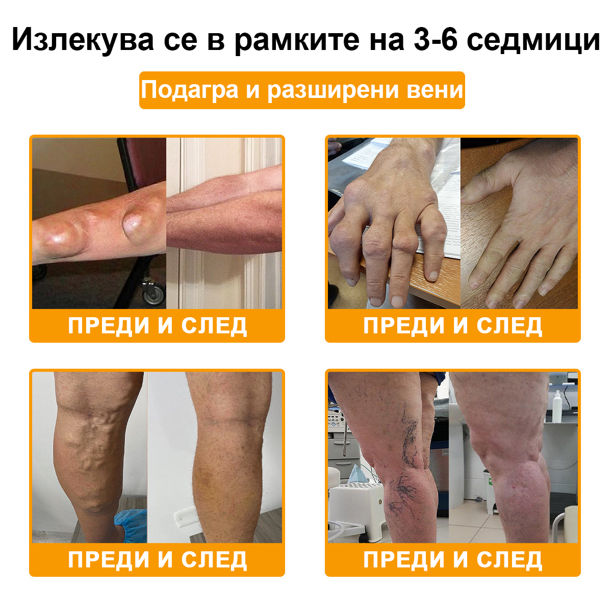 ArthroFree™ Krema za lajšanje bolečin v kosteh s čebeljim strupom (Posebej za starejše, priporočena s strani Ameriške akademije ortopedske kirurgije - AAOS)❤️🔥