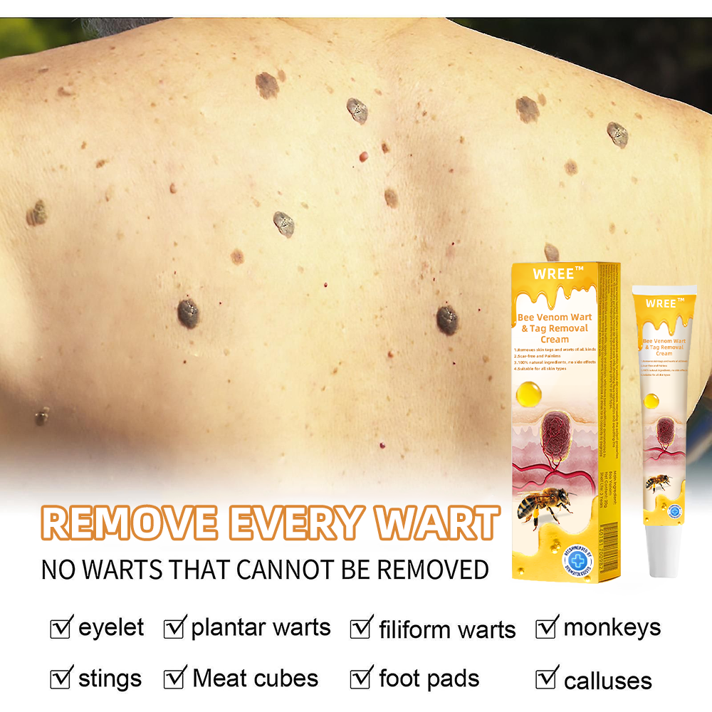 🐹WREE™ Bee Venom Wart & Tag Removal Cream(👨⚕Suitable for all skin types)🐝(🔥Last day promotion 60% off)