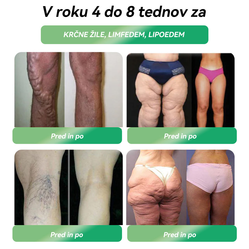 𝑈𝑟𝑎𝑑𝑛𝑎 𝑡𝑟𝑔𝑜𝑣𝑖𝑛𝑎｜𝑆𝑇𝐷𝐸𝐼® 𝐺𝐿𝑃-1 𝑃𝑒𝑟𝑜𝑟𝑎𝑙𝑛𝑎 𝑟𝑎𝑧𝑡𝑜𝑝𝑖𝑛𝑎 𝑧𝑎 ℎ𝑢𝑗š𝑎𝑛𝑗𝑒 👨‍⚕️ 𝑃𝑟𝑖𝑚𝑒𝑟𝑛𝑎 𝑧𝑎 𝑑𝑒𝑏𝑒𝑙𝑜𝑠𝑡, 𝑏𝑜𝑙𝑒𝑧𝑛𝑖 𝑠𝑟𝑐𝑎 𝑖𝑛 𝑜ž𝑖𝑙𝑗𝑎, 𝑠𝑙𝑎𝑑𝑘𝑜𝑟𝑛𝑜 𝑏𝑜𝑙𝑒𝑧𝑒𝑛, 𝑠𝑝𝑎𝑙𝑛𝑜 𝑎𝑝𝑛𝑒𝑗𝑜, 𝑡𝑒ž𝑎𝑣𝑒 𝑠 𝑠𝑘𝑙𝑒𝑝𝑖 𝑖𝑛 𝑑𝑟𝑢𝑔𝑒 𝑧𝑑𝑟𝑎𝑣𝑠𝑡𝑣𝑒𝑛𝑒 𝑡𝑒ž𝑎𝑣𝑒🍀