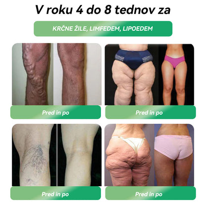 𝑈𝑟𝑎𝑑𝑛𝑎 𝑡𝑟𝑔𝑜𝑣𝑖𝑛𝑎｜𝑆𝑇𝐷𝐸𝐼® 𝐺𝐿𝑃-1 𝑃𝑒𝑟𝑜𝑟𝑎𝑙𝑛𝑎 𝑟𝑎𝑧𝑡𝑜𝑝𝑖𝑛𝑎 𝑧𝑎 ℎ𝑢𝑗š𝑎𝑛𝑗𝑒 👨‍⚕️ 𝑃𝑟𝑖𝑚𝑒𝑟𝑛𝑎 𝑧𝑎 𝑑𝑒𝑏𝑒𝑙𝑜𝑠𝑡, 𝑏𝑜𝑙𝑒𝑧𝑛𝑖 𝑠𝑟𝑐𝑎 𝑖𝑛 𝑜ž𝑖𝑙𝑗𝑎, 𝑠𝑙𝑎𝑑𝑘𝑜𝑟𝑛𝑜 𝑏𝑜𝑙𝑒𝑧𝑒𝑛, 𝑠𝑝𝑎𝑙𝑛𝑜 𝑎𝑝𝑛𝑒𝑗𝑜, 𝑡𝑒ž𝑎𝑣𝑒 𝑠 𝑠𝑘𝑙𝑒𝑝𝑖 𝑖𝑛 𝑑𝑟𝑢𝑔𝑒 𝑧𝑑𝑟𝑎𝑣𝑠𝑡𝑣𝑒𝑛𝑒 𝑡𝑒ž𝑎𝑣𝑒🍀