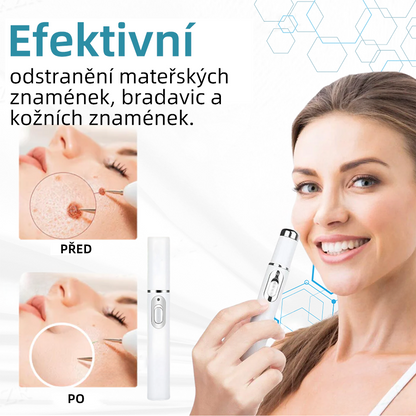 KIDSNEED®💃 Neinvazivno lasersko pero za odstranjevanje kretenj in bradavic - močno🔥🔥🔥Priporočilo Slovenskega dermatološkega društva (SDD)