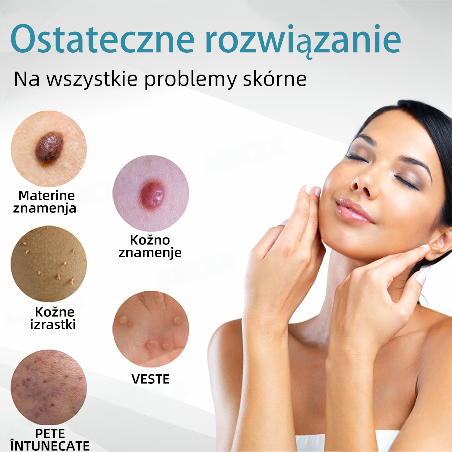 KIDSNEED®💃 Neinvazivno lasersko pero za odstranjevanje kretenj in bradavic - močno🔥🔥🔥Priporočilo Slovenskega dermatološkega društva (SDD)