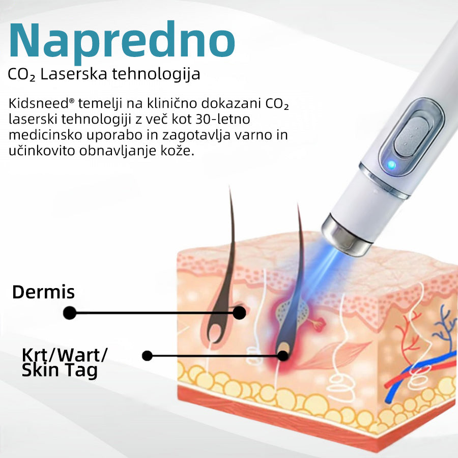 KIDSNEED®💃 Neinvazivno lasersko pero za odstranjevanje kretenj in bradavic - močno🔥🔥🔥Priporočilo Slovenskega dermatološkega društva (SDD)