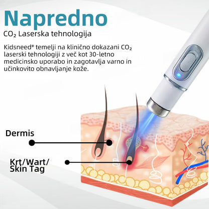 KIDSNEED®💃 Neinvazivno lasersko pero za odstranjevanje kretenj in bradavic - močno🔥🔥🔥Priporočilo Slovenskega dermatološkega društva (SDD)