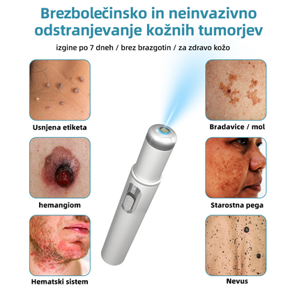 KIDSNEED®💃 Neinvazivno lasersko pero za odstranjevanje kretenj in bradavic - močno🔥🔥🔥Priporočilo Slovenskega dermatološkega društva (SDD)