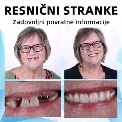 𝐁𝐢𝐤𝐞𝐧𝐝𝐚™Silikonski set za zobno protezo🔥  (⏰omejen popust, 30 minut⏰) ‍🦷👩‍⚕️