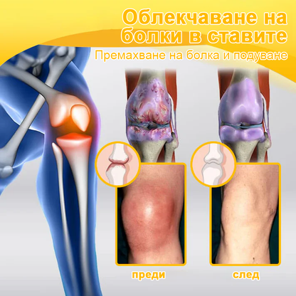 ArthroFree™ Krema za lajšanje bolečin v kosteh s čebeljim strupom (Posebej za starejše, priporočena s strani Ameriške akademije ortopedske kirurgije - AAOS)❤️‍🔥